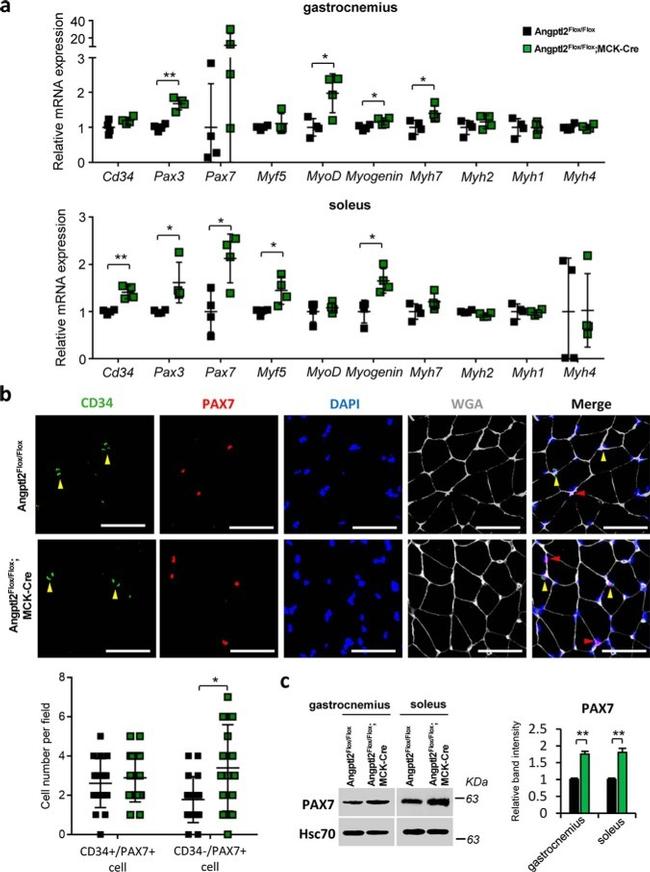 PAX7 Antibody in Immunohistochemistry (IHC)