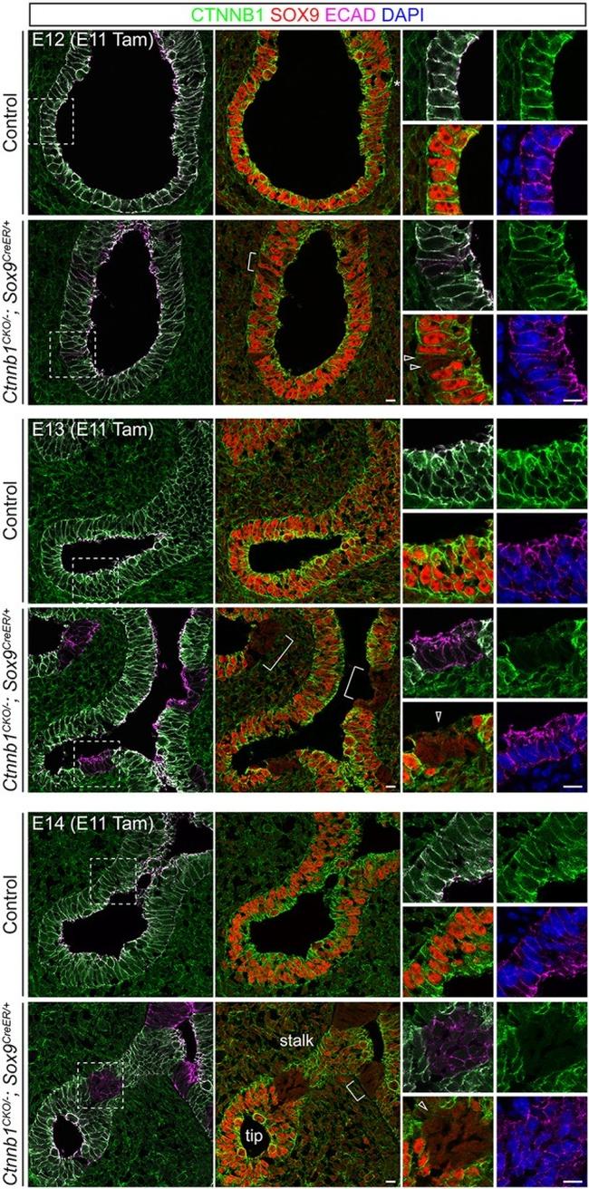 CD324 (E-Cadherin) Antibody in Immunohistochemistry (IHC)