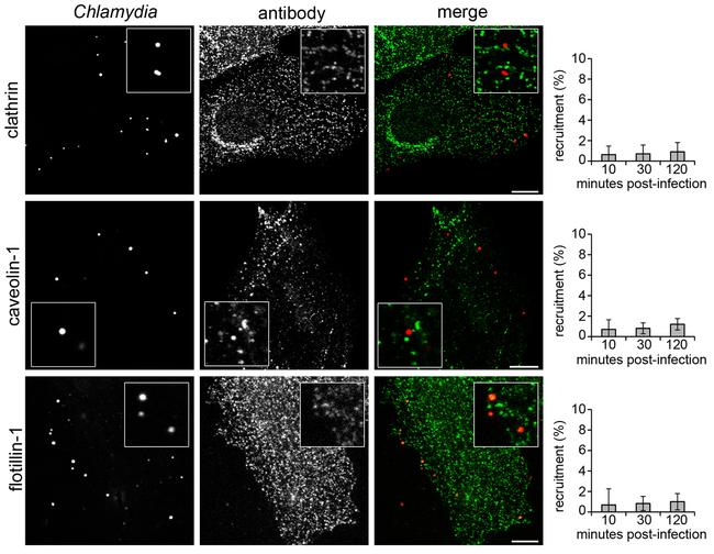 Clathrin Heavy Chain Antibody in Immunocytochemistry (ICC/IF)