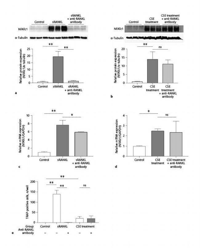 NFATC1 Antibody in Western Blot (WB)