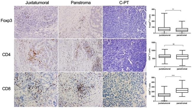 CD4 Antibody in Immunohistochemistry (IHC)