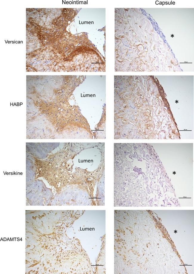 ADAMTS4 Antibody in Immunohistochemistry (IHC)