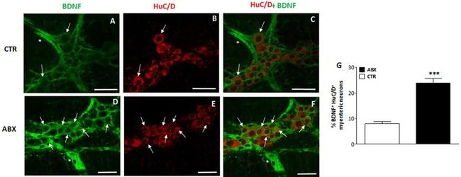 HuC/HuD Antibody in Immunohistochemistry (IHC)