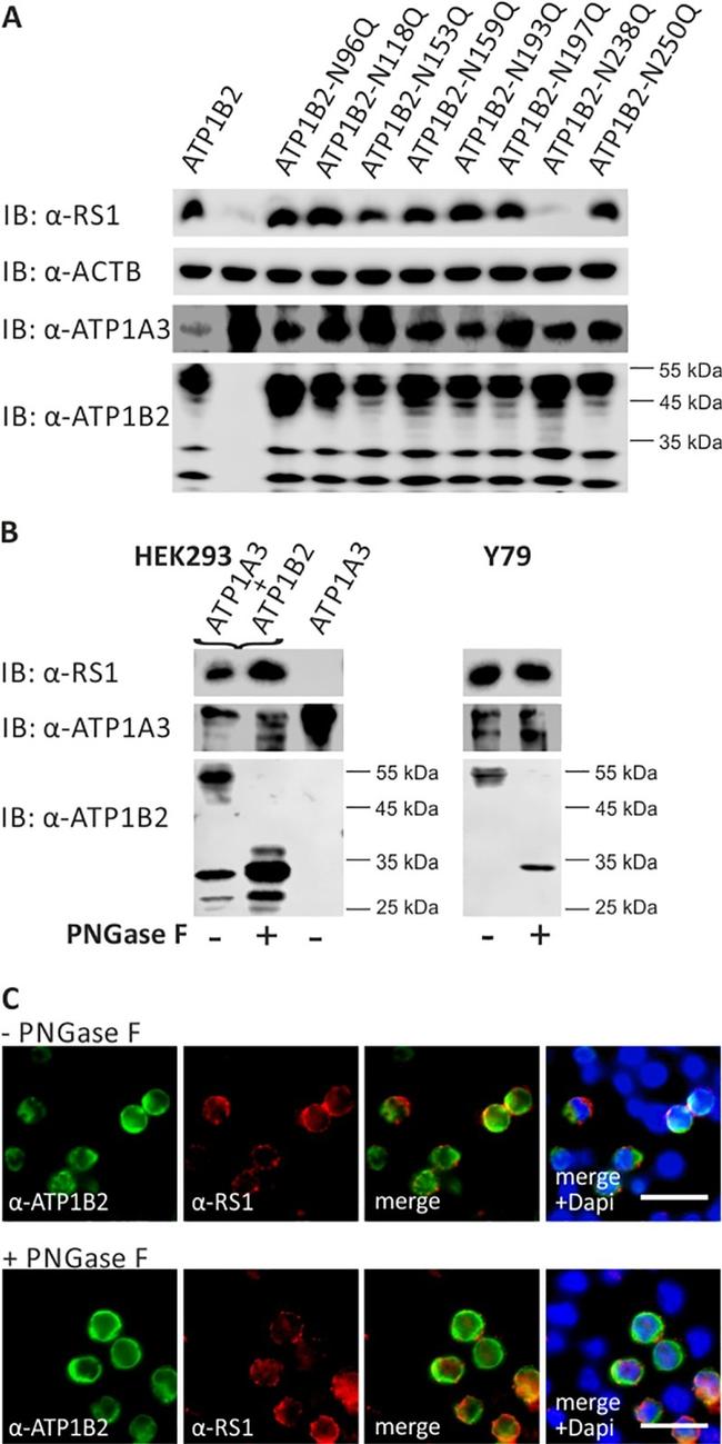 ATP1A3 Antibody in Western Blot (WB)