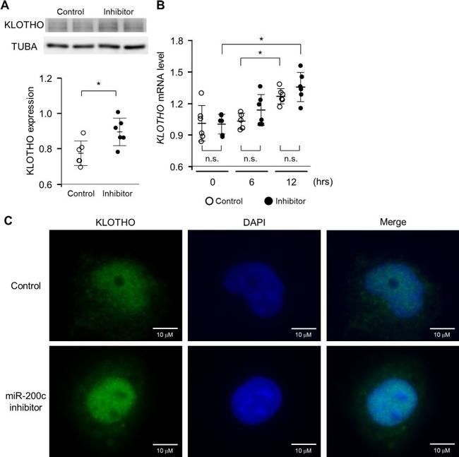 Klotho Antibody in Immunocytochemistry (ICC/IF)