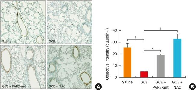 Claudin 1 Antibody in Immunohistochemistry (IHC)