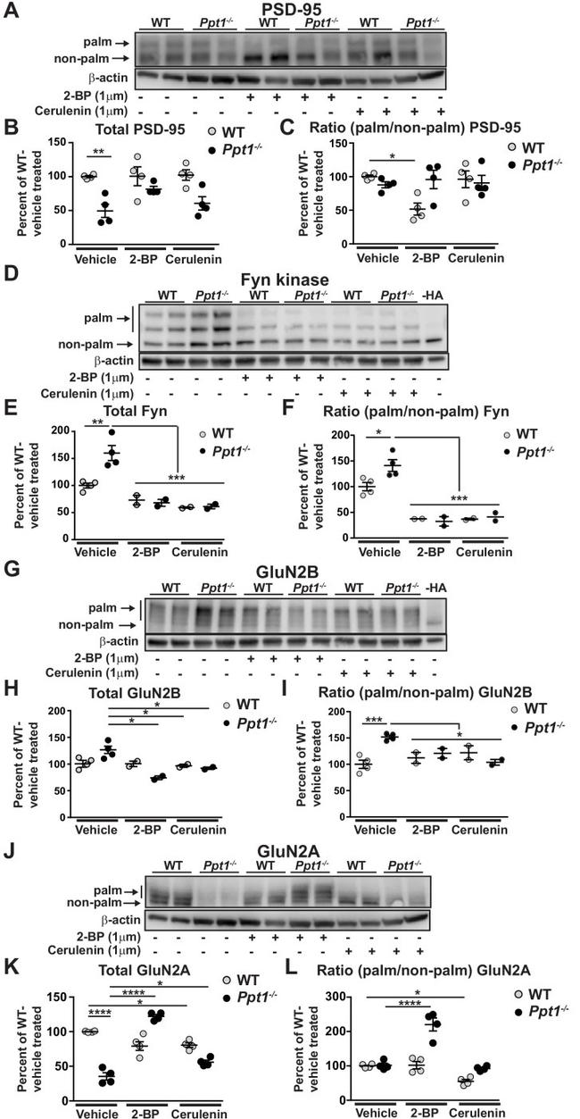 beta Actin Antibody in Western Blot (WB)