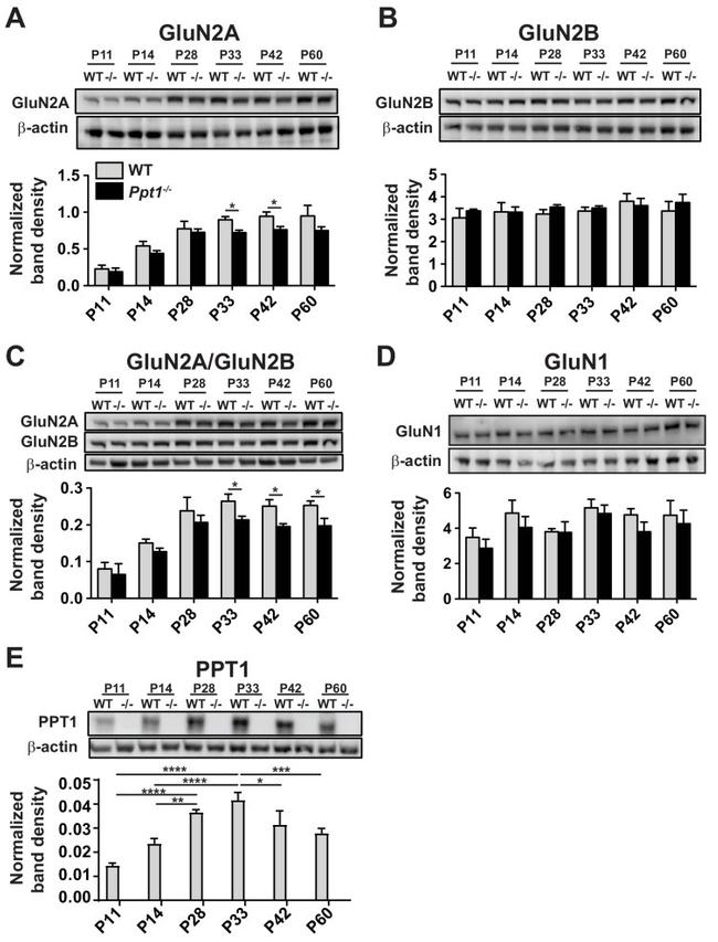 beta Actin Antibody in Western Blot (WB)