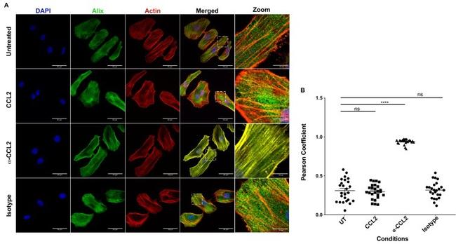 Alix Antibody in Immunocytochemistry (ICC/IF)