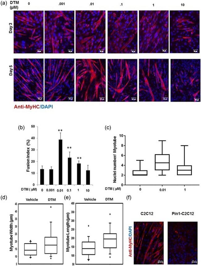 Myosin 4 Antibody in Immunocytochemistry (ICC/IF)