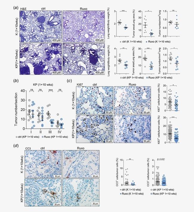 Ki-67 Antibody in Immunohistochemistry (IHC)