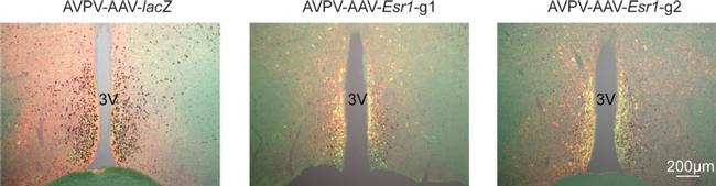 mCherry Antibody in Immunohistochemistry (IHC)