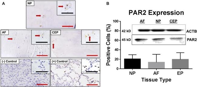 PAR2 Antibody in Western Blot, Immunohistochemistry (WB, IHC)