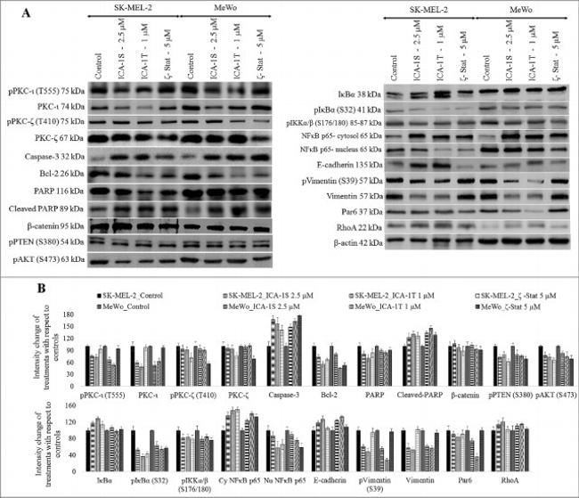 Phospho-PKC lambda/iota (Thr557, Thr564) Antibody in Western Blot (WB)