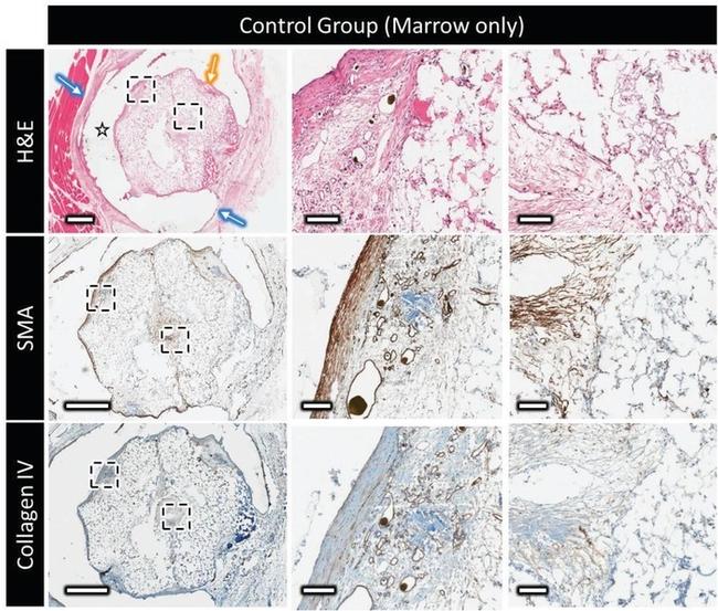 Alpha-Smooth Muscle Actin Antibody in Immunohistochemistry (IHC)