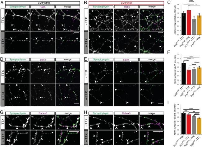 Rabex-5 Antibody in Immunocytochemistry (ICC/IF)