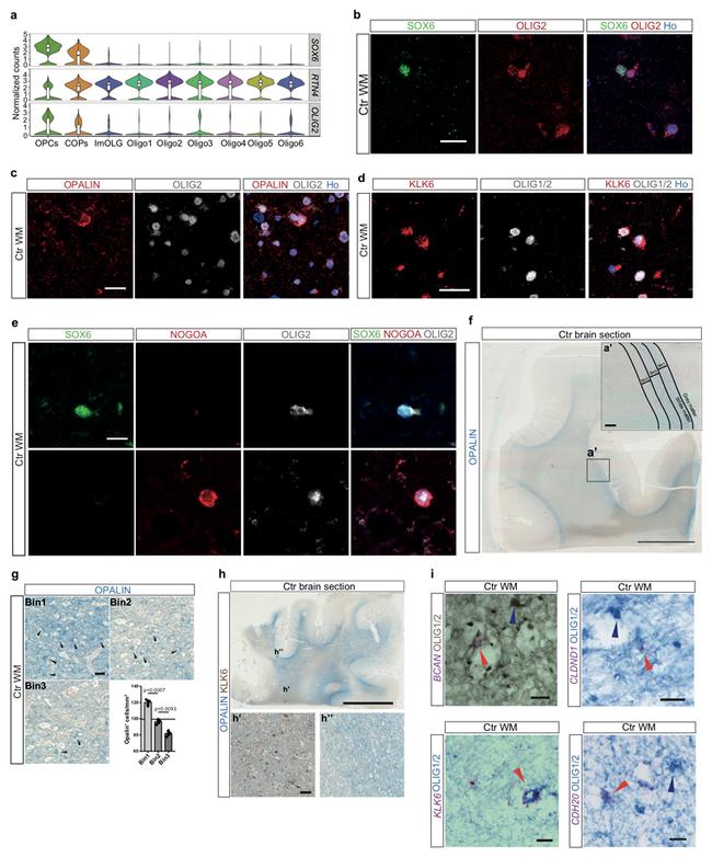 Kallikrein 6 Antibody in Immunocytochemistry, Immunohistochemistry (ICC/IF, IHC)