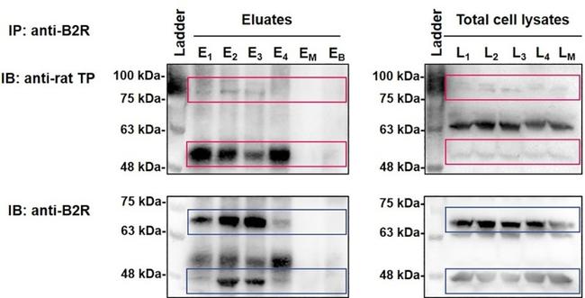 BDKRB2 Antibody in Western Blot, Immunoprecipitation (WB, IP)