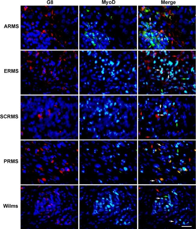 MYOD Antibody in Immunocytochemistry, Immunohistochemistry (ICC/IF, IHC)