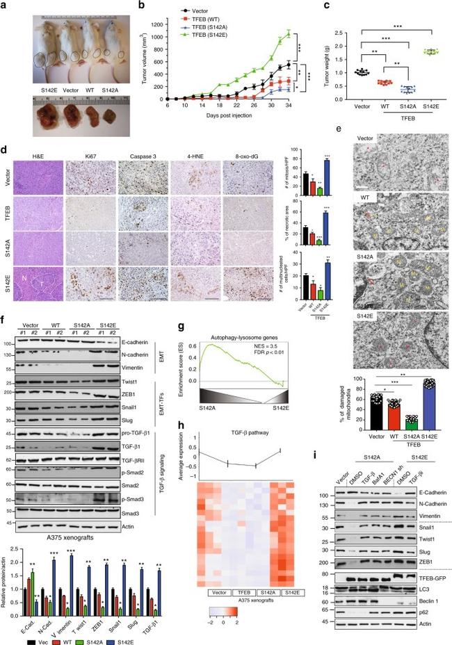 TFEB Antibody in Immunohistochemistry (IHC)