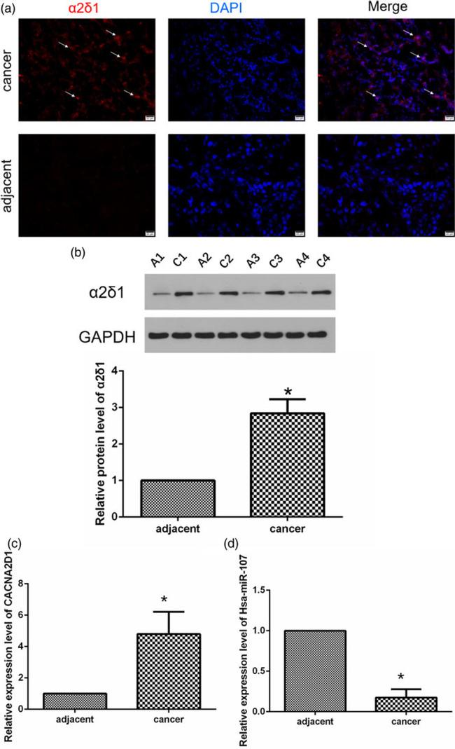 CACNA2D1 Antibody in Western Blot (WB)