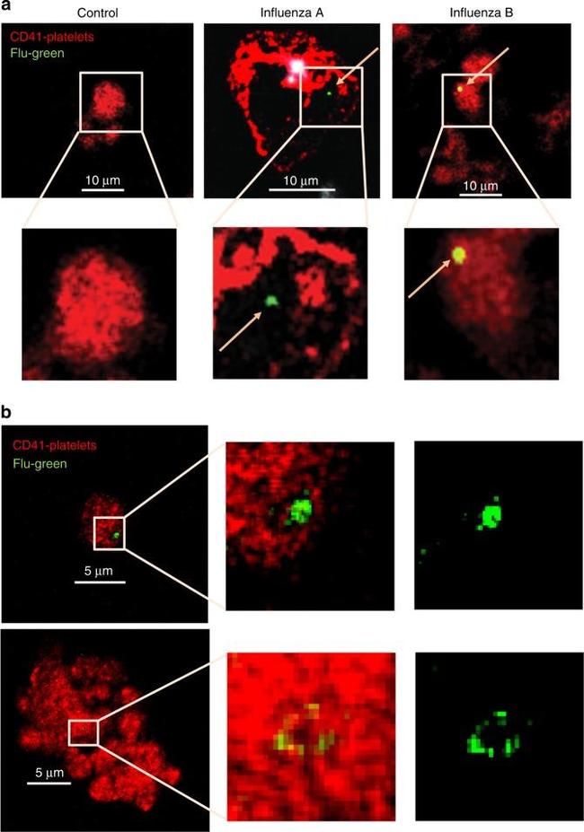 Influenza B NP Antibody in Immunocytochemistry (ICC/IF)