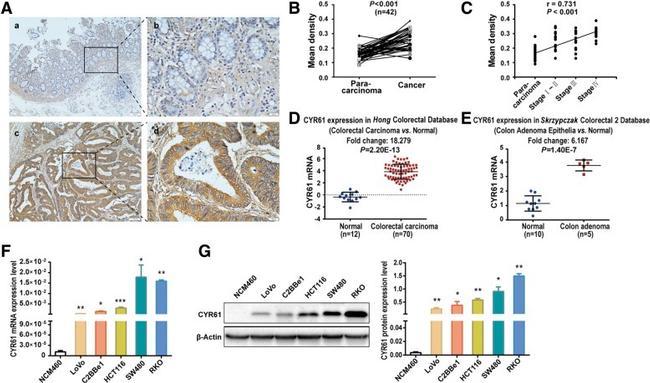 CYR61 Antibody in Immunohistochemistry (IHC)