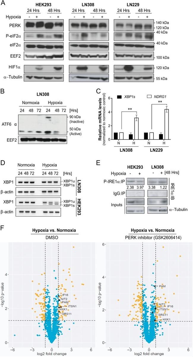 Phospho-IRE1 alpha (Ser724) Antibody in Western Blot, Immunoprecipitation (WB, IP)