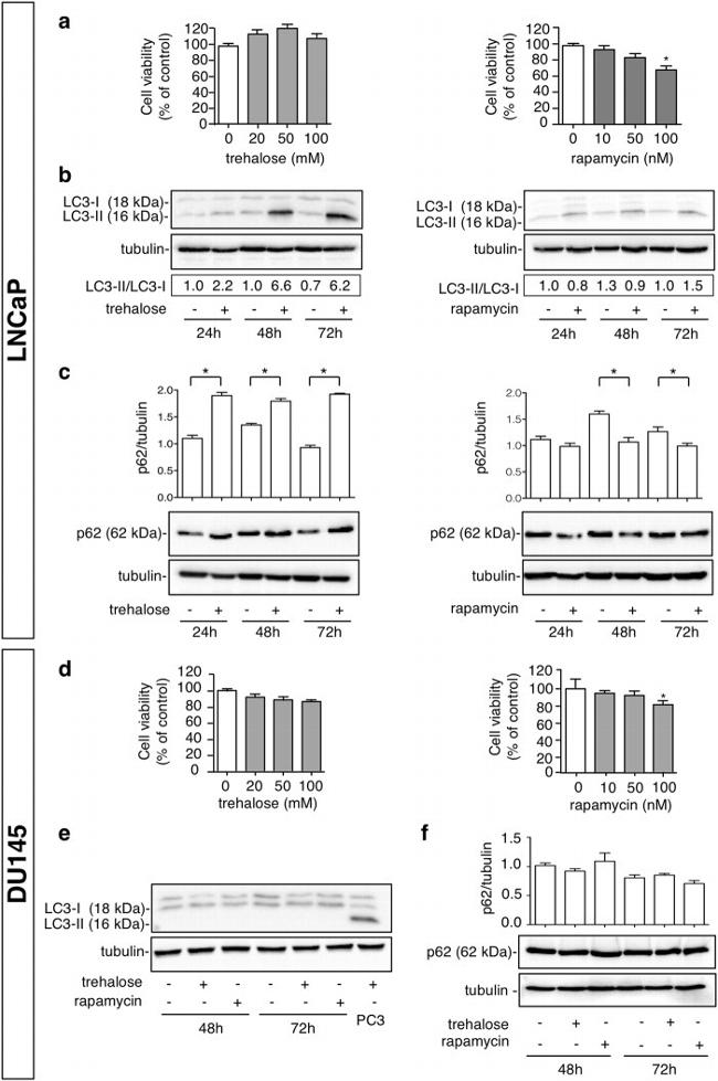 SQSTM1 Antibody in Western Blot (WB)