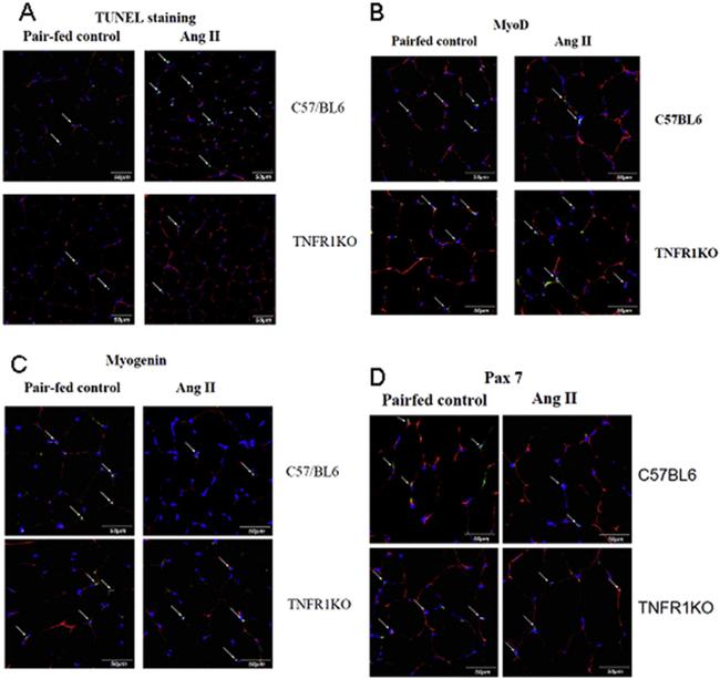 MYOD Antibody in Immunocytochemistry (ICC/IF)