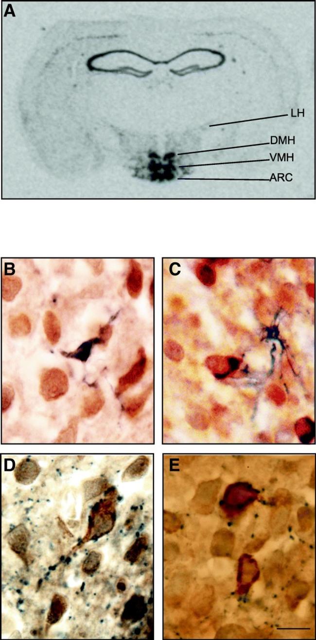 NPY Antibody in Immunohistochemistry (IHC)