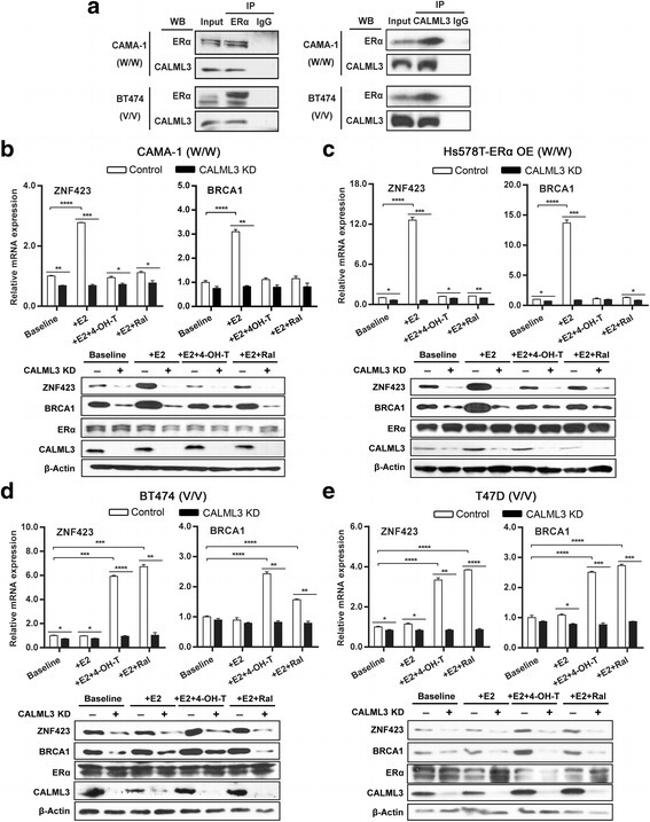 Estrogen Receptor alpha Antibody in Western Blot, Immunoprecipitation (WB, IP)