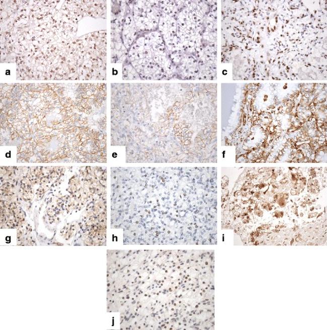 SETD2 Antibody in Immunohistochemistry (Paraffin) (IHC (P))