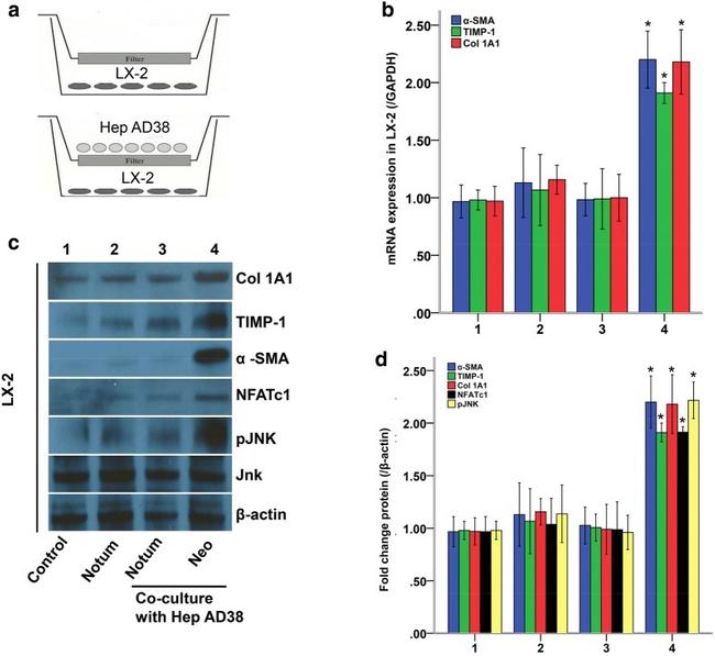 Collagen I Antibody in Western Blot (WB)