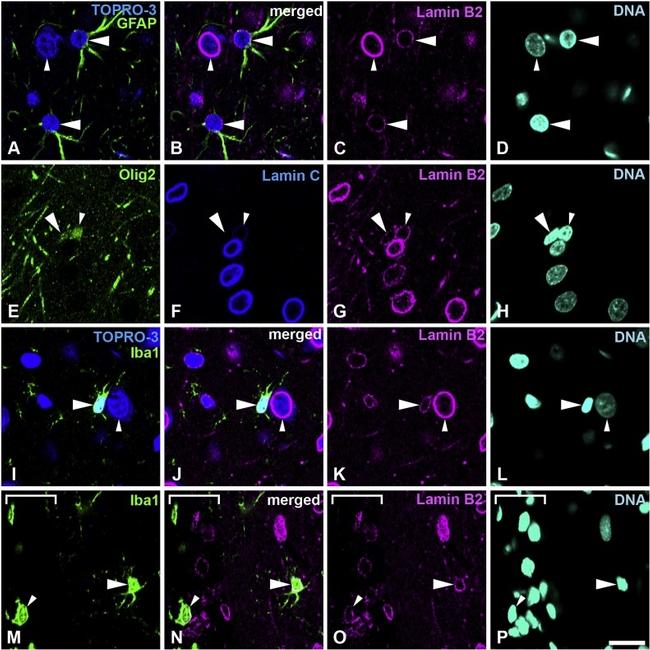 Lamin B2 Antibody in Immunohistochemistry (IHC)