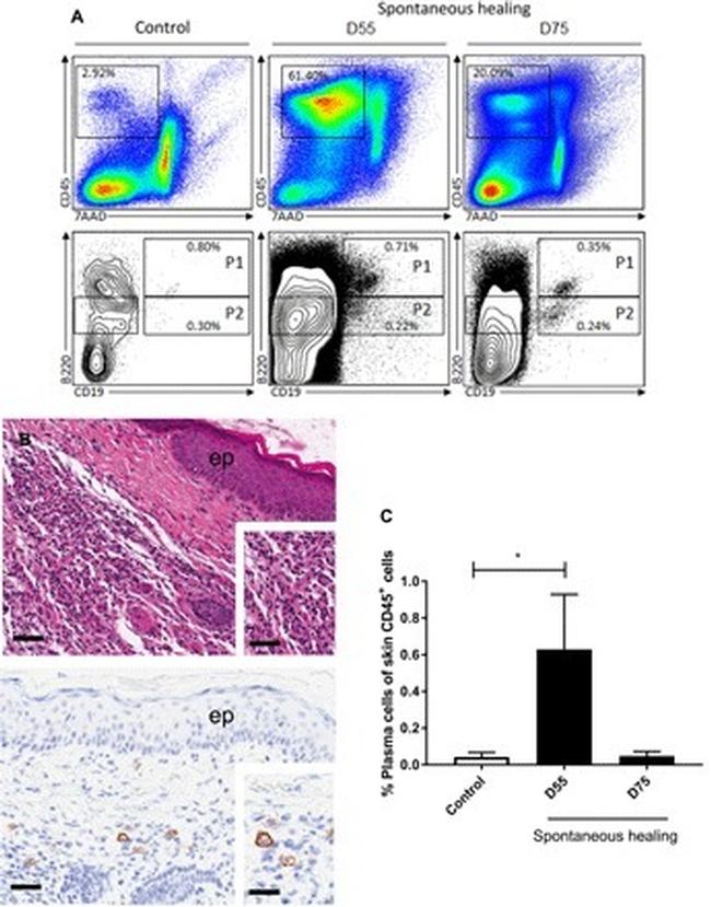 CD138 Antibody in Immunohistochemistry (IHC)