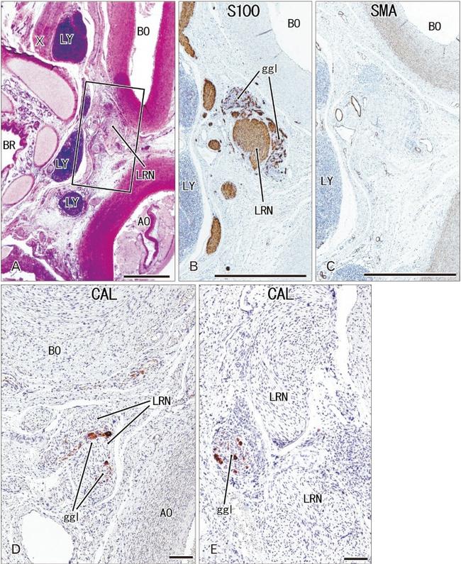 Calretinin Antibody in Immunohistochemistry (IHC)