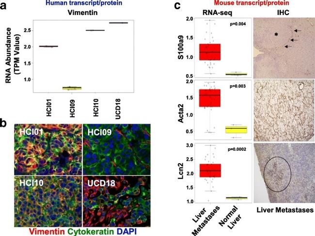 Cytokeratin Pan Antibody in Immunohistochemistry (IHC)