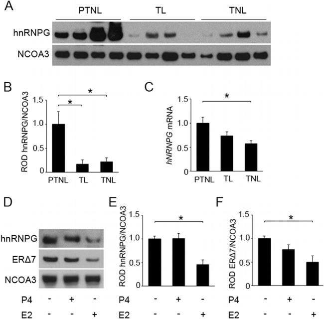 SRC3 Antibody in Western Blot (WB)