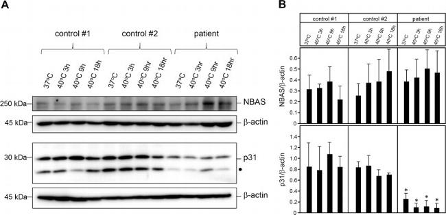 NBAS Antibody in Western Blot (WB)