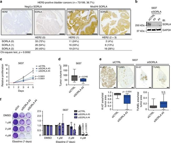 Ki-67 Antibody in Immunohistochemistry (IHC)