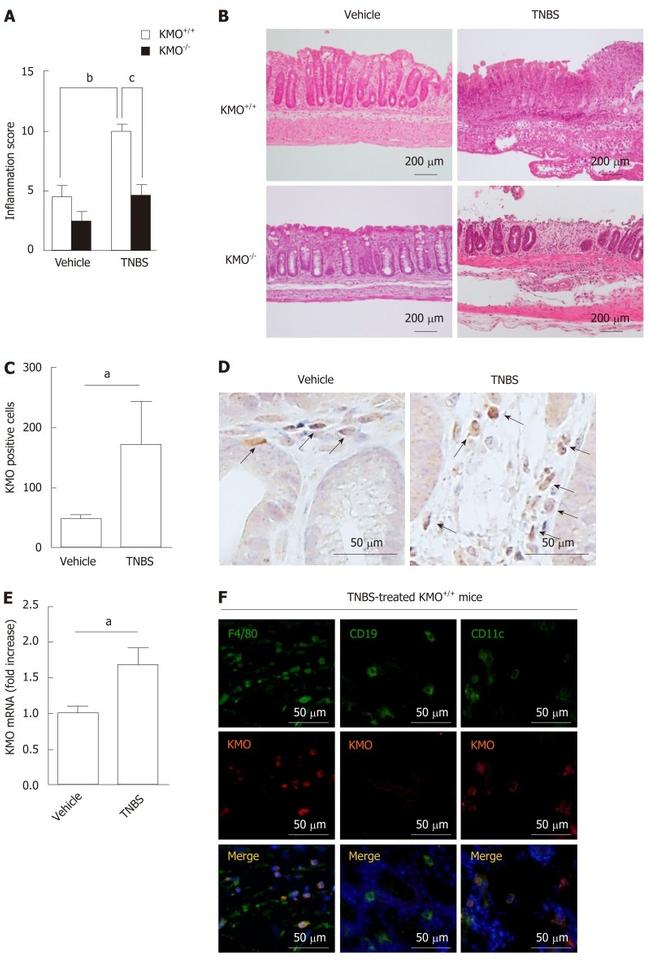 CD19 Antibody in Immunohistochemistry (IHC)