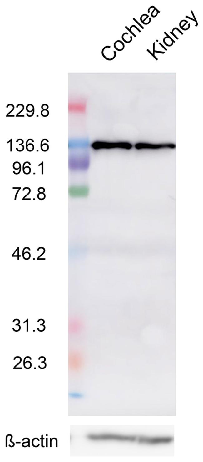 Calcium Sensing Receptor Antibody in Western Blot (WB)