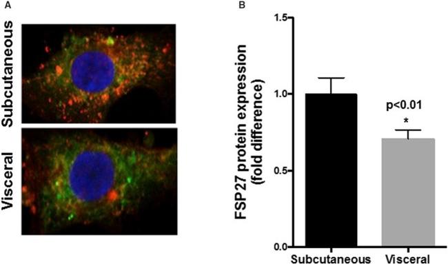 CIDEC Antibody in Immunocytochemistry (ICC/IF)