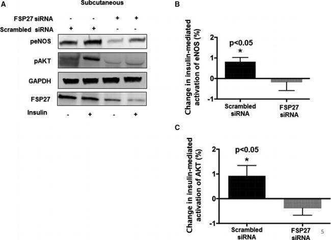 AKT Pan Antibody in Western Blot (WB)