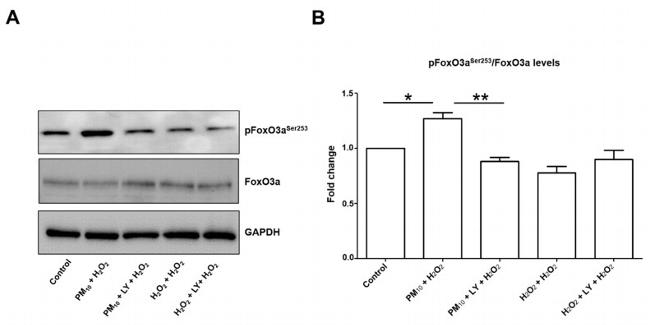 Phospho-FOXO3A (Ser253) Antibody in Western Blot (WB)