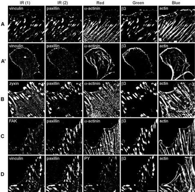 FAK Antibody in Immunocytochemistry (ICC/IF)