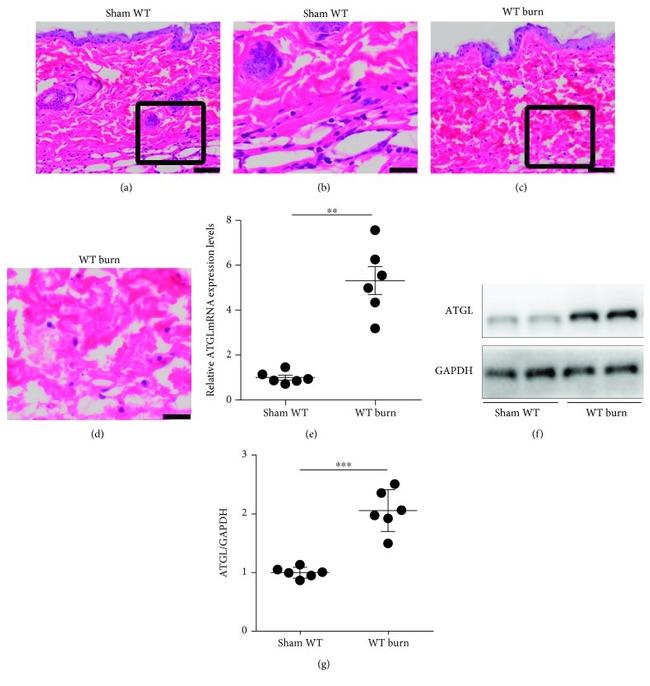 ATGL Antibody in Western Blot (WB)