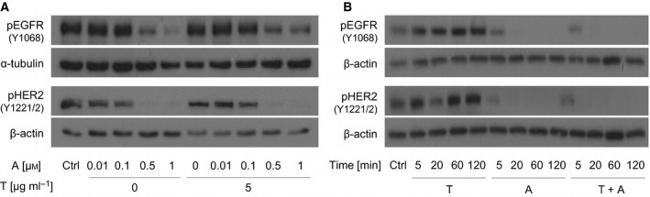 Phospho-EGFR (Tyr1068) Antibody in Western Blot (WB)