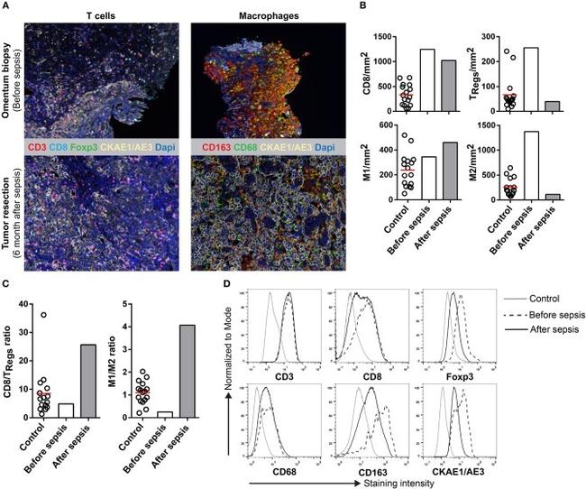 FOXP3 Antibody in Immunohistochemistry (IHC)